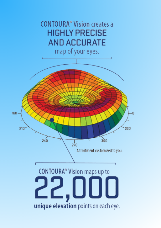 22,000 Elevation Points